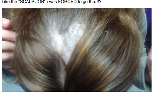 scalp.jpg